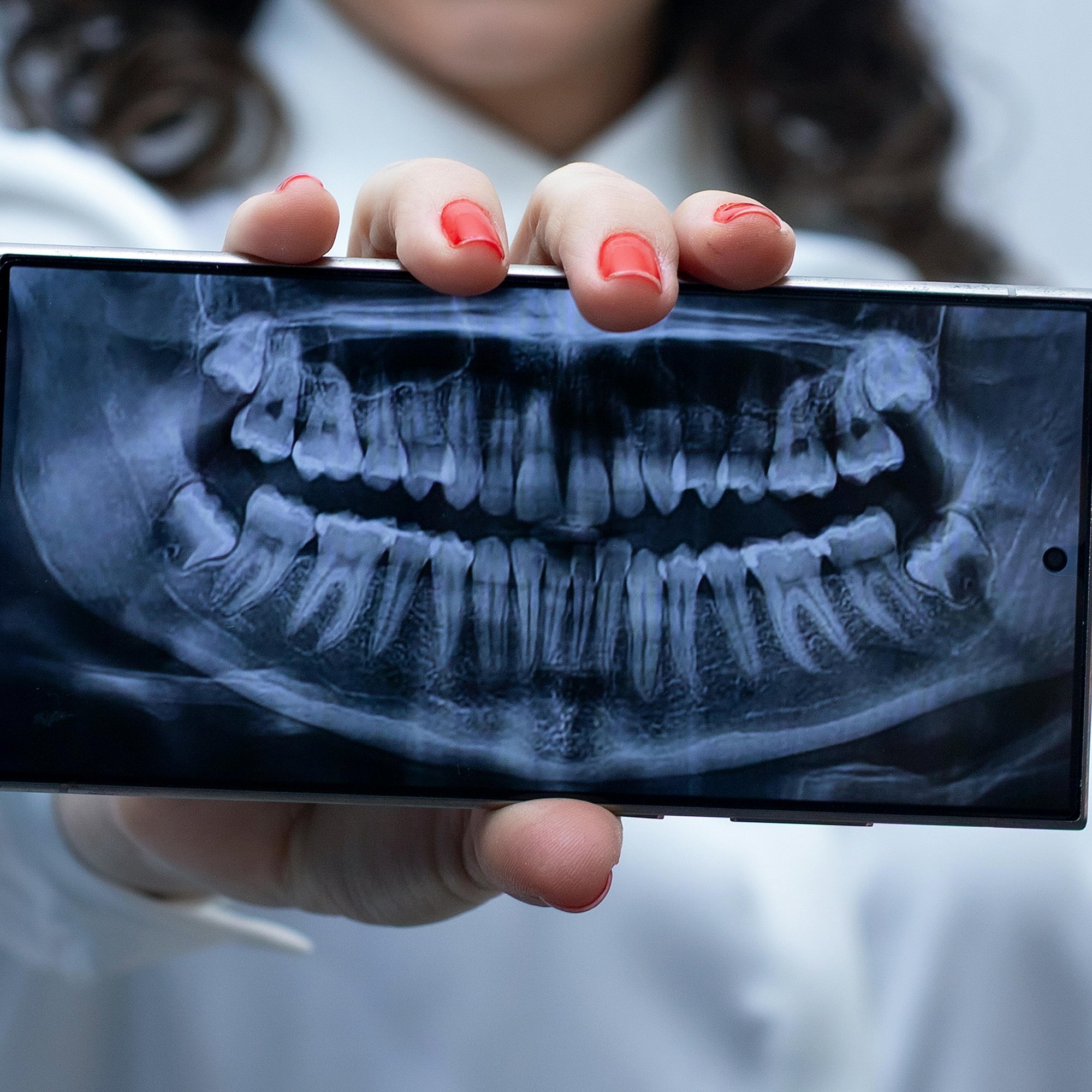 Patient (5)-Apr-20-2026-07-38-53-8288-PM